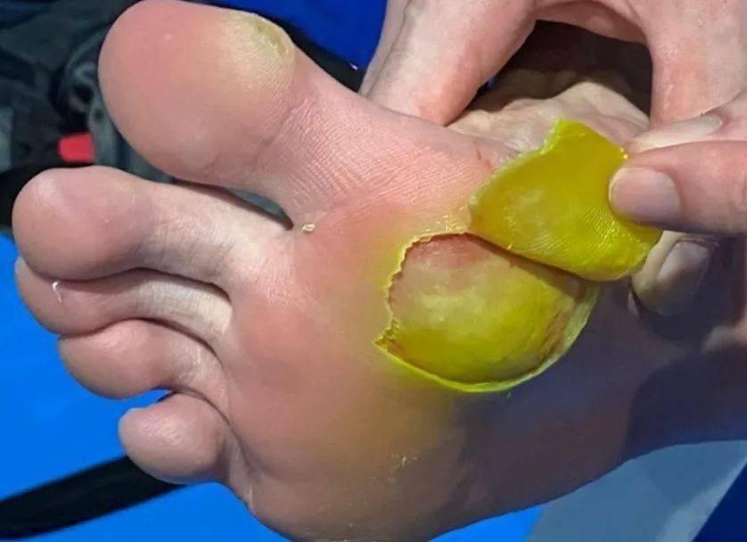 德国队碾压丹麦队,李梓嘉惊艳四座 德国队碾压丹麦队,李梓嘉惊艳四座